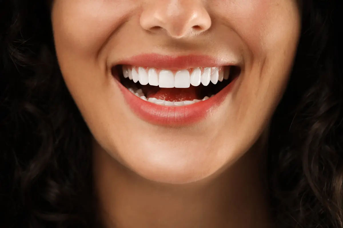 Sonrisa sana y cuidada después de un tratamiento dental