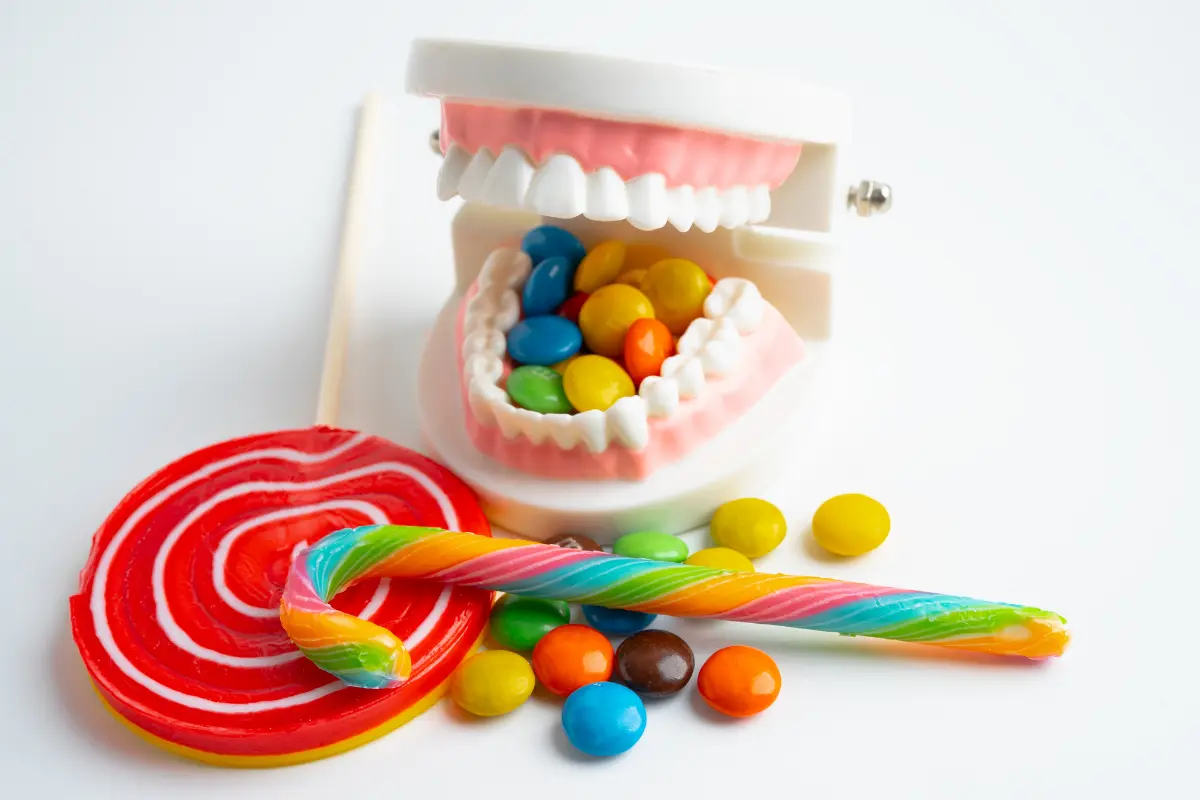 Maqueta dental con alimentos relacionados con la aparición de caries