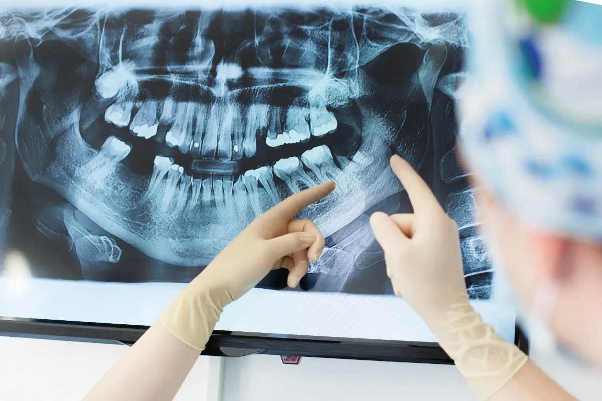 Radiografía panorámica para detectar lesiones dentales y óseas