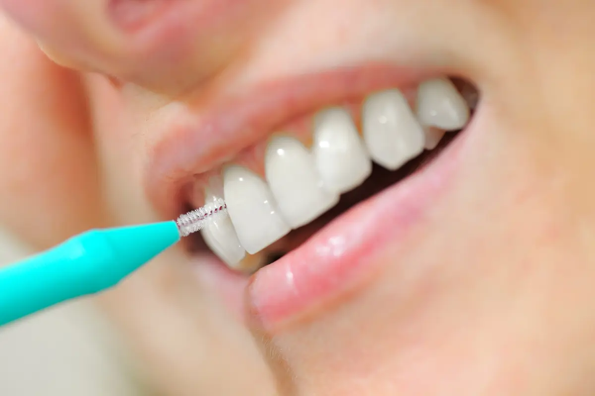 Uso de cepillo interdental para limpiar entre los dientes
