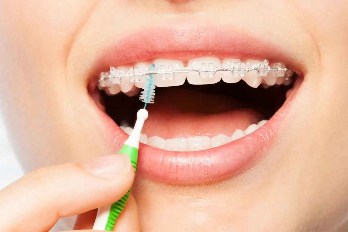 Limpieza dental profesional para prevenir problemas bucodentales