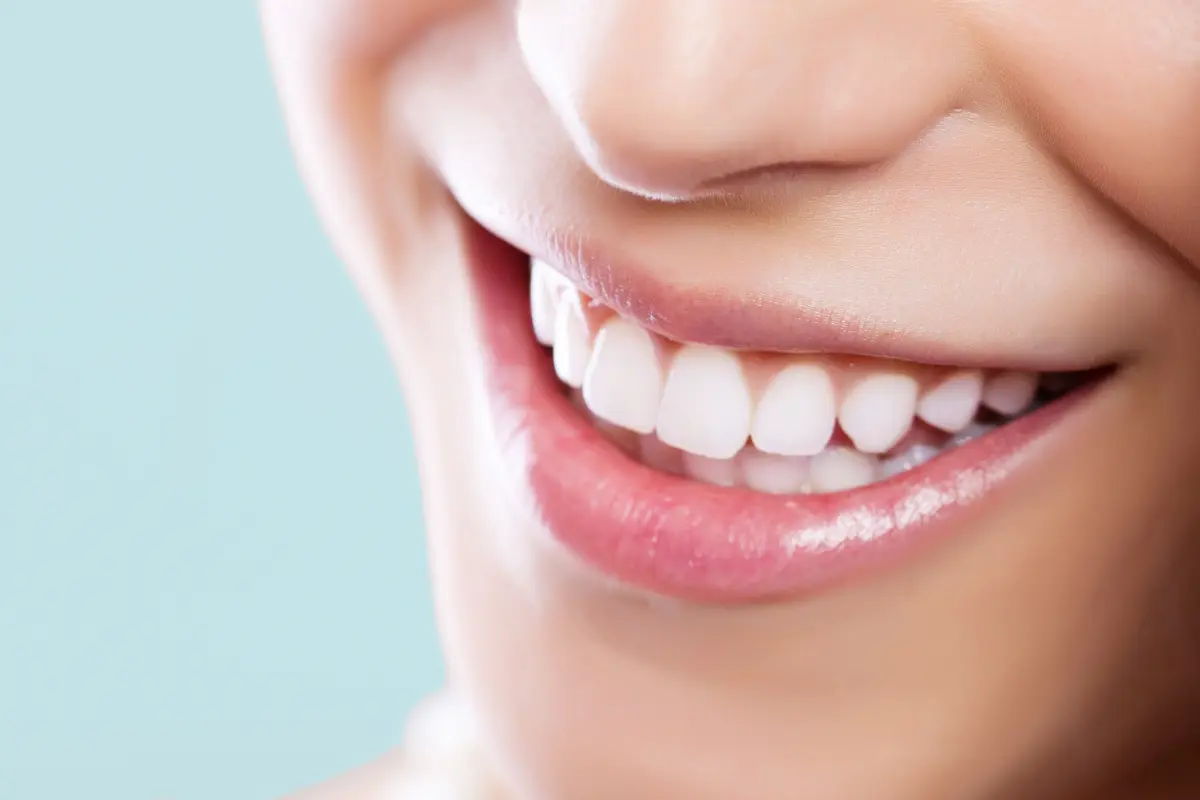 Sonrisa rehabilitada con prótesis dental fija