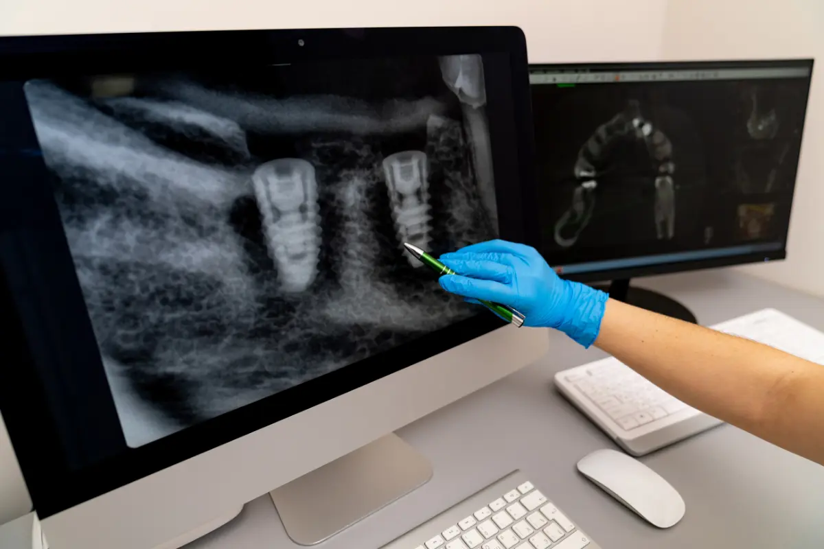 Profesional analizando una radiografía oral digital